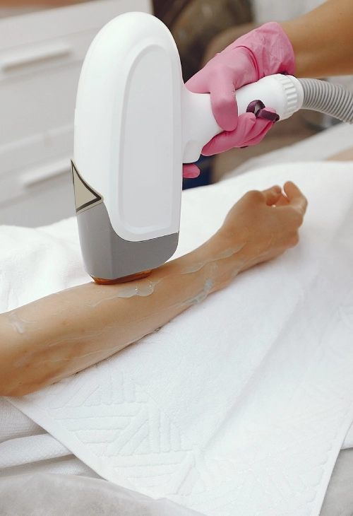 Laser Hair Removal